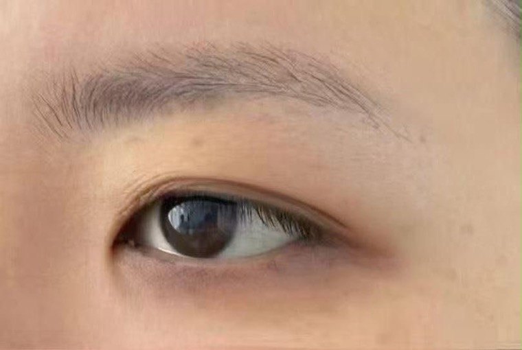 Before